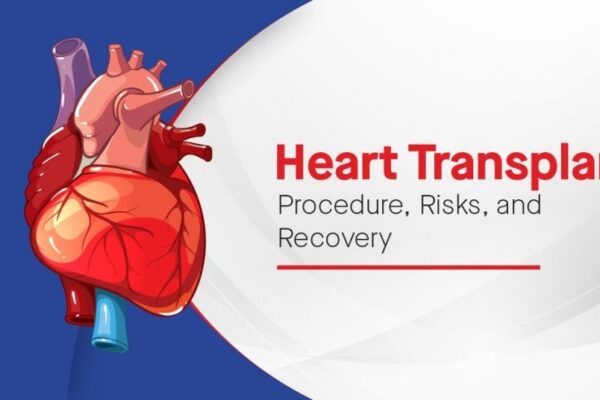 Heart Transplant: What is it, Causes, Procedure, Risks, Recovery.